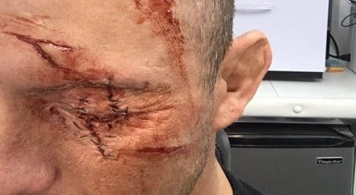 Ковбой шокировал фанатов жутким фото