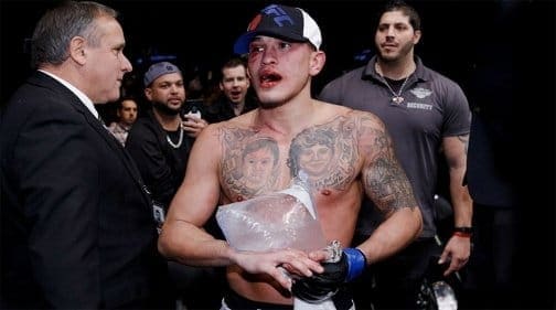 Энтони Петтис возвращается в легкий вес