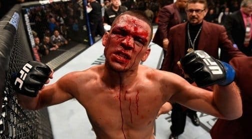 Нейт Диас: «Мне не предлагали никаких боев»