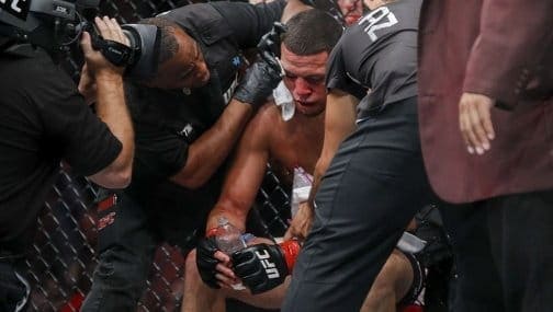 Ник Диас: «Если бы я был в углу Нейта на UFC 202, он бы прикончил Конора»