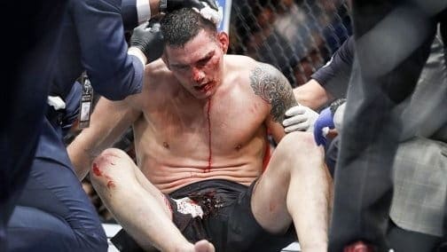 Майкл Биспинг поддержал Криса Вайдмэна