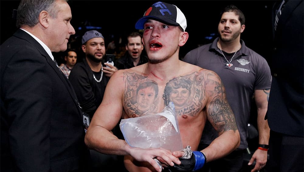 Экс-чемпион UFC обвиняет USADA в нанесении травмы