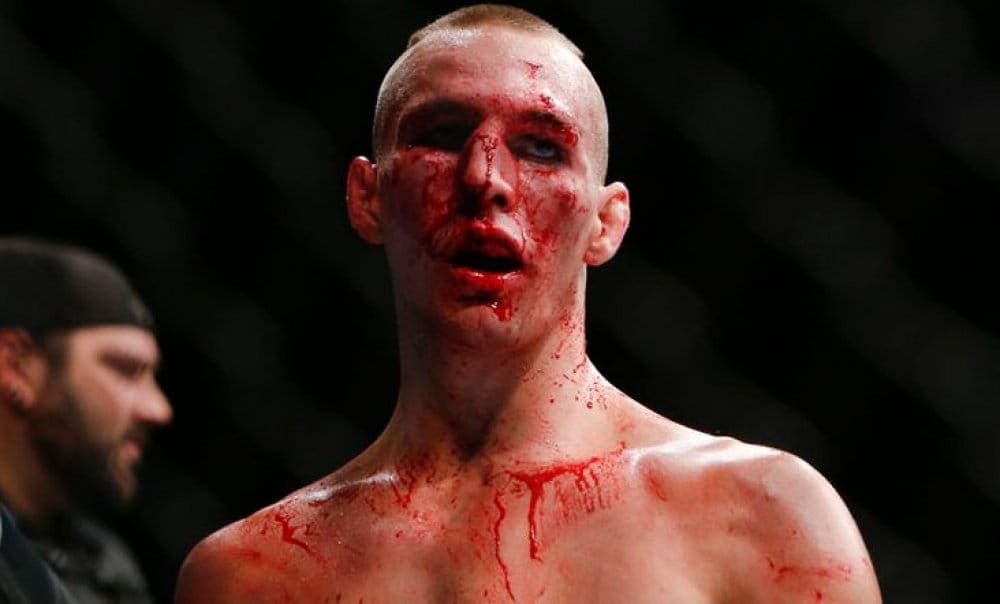 Rory MacDonald (Рори МакДональд)