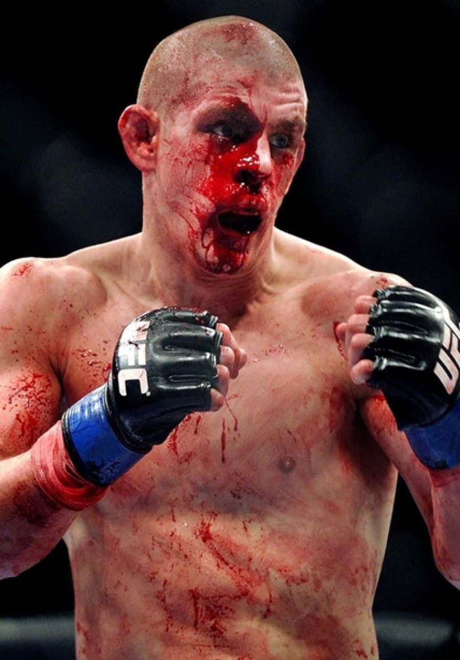 Джо Лоузон (Joe Lauzon)