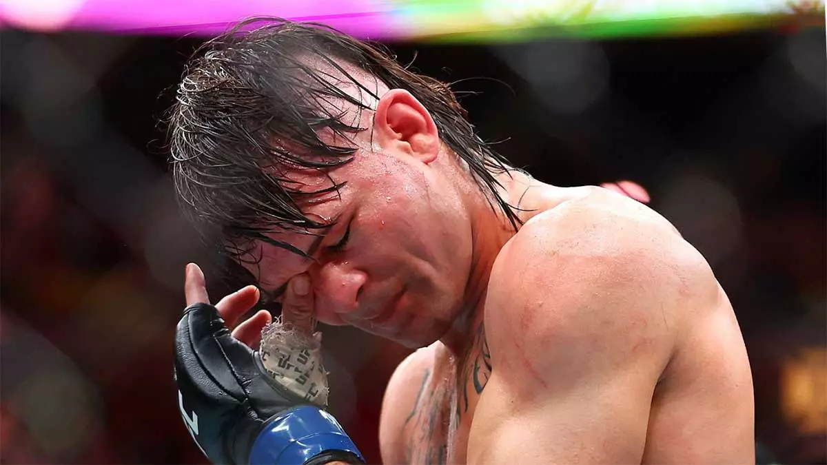 Диего Лопес